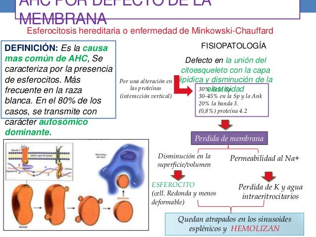 esferocitosis hereditaria pediatria